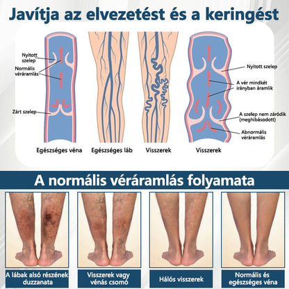 💧ATTDX® Növényi ödéma enyhítő krém nigellával💧💧