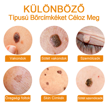 🏵️Vsoxa™ méhméreg szemölcs és anyajegy eltávolító krém (Utolsó napi akció, 80% kedvezmény)🌷