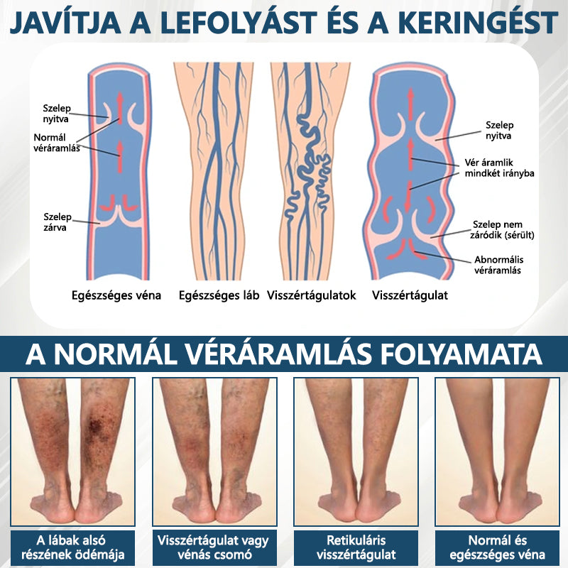 Cvreoz® Fekete kömény Ödéma méregtelenítő gyógynövénykrém - a gyors, látható enyhülés érdekében🍃🍃🍃
