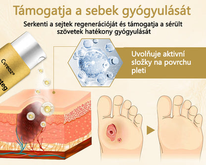 Cvreoz® méhméreg gyógyító spray a sebek gyógyulására és regenerálására a kezeken és a lábakon🌿