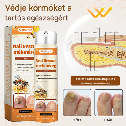 💥 2025 Korlátozott 70% KEDVEZMÉNY ️⏳ Ceoerty® NailRescue Kolirin méhméreg körömgomba spray 💥 Minden körömproblémát orvosolhatsz 2 héten belül👣👣👣