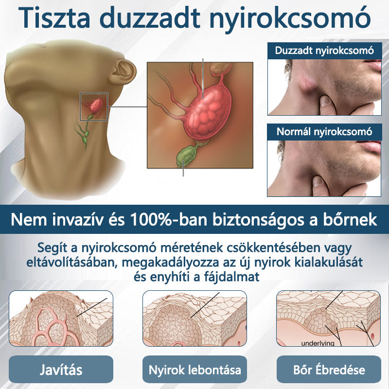 Cvreoz® Fekete kömény Ödéma méregtelenítő gyógynövénykrém - a gyors, látható enyhülés érdekében🍃🍃🍃