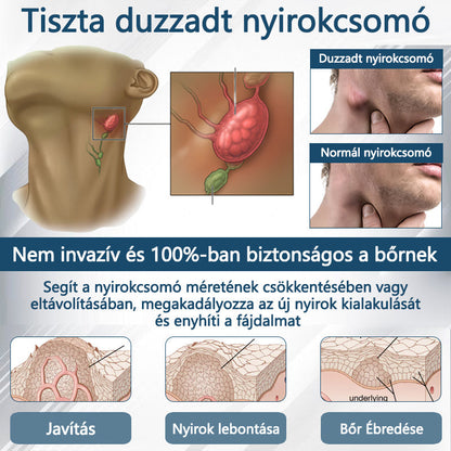Cvreoz® Fekete kömény Ödéma méregtelenítő gyógynövénykrém - a gyors, látható enyhülés érdekében🍃🍃🍃