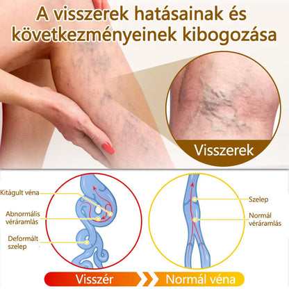 ✅flysmus™ méhméreg kezelő krém🐝: Ekcéma, pikkelysömör, akne, rosacea, gombás fertőzések, szemölcsök kezelése🐝🐝🐝